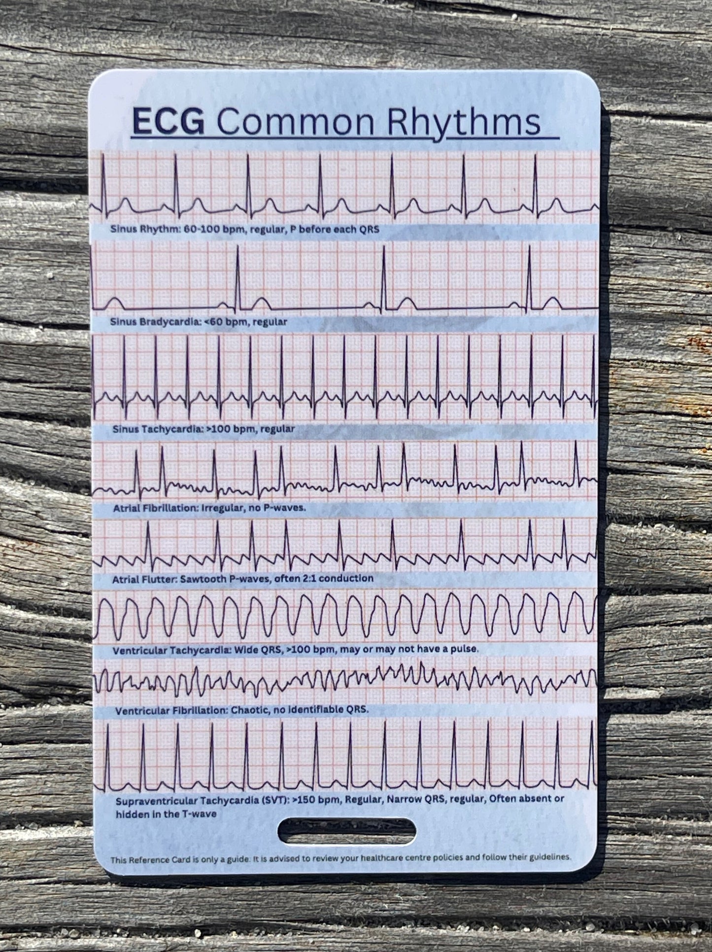 ECG Rhythms + Guide