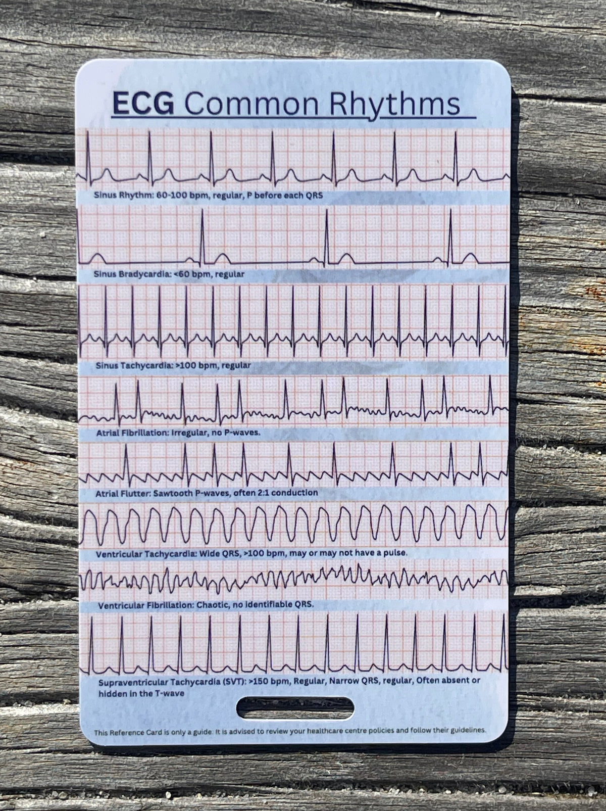 ECG Rhythms + Guide Reference Card – The Nurse Deck